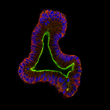 small intestinal organoid